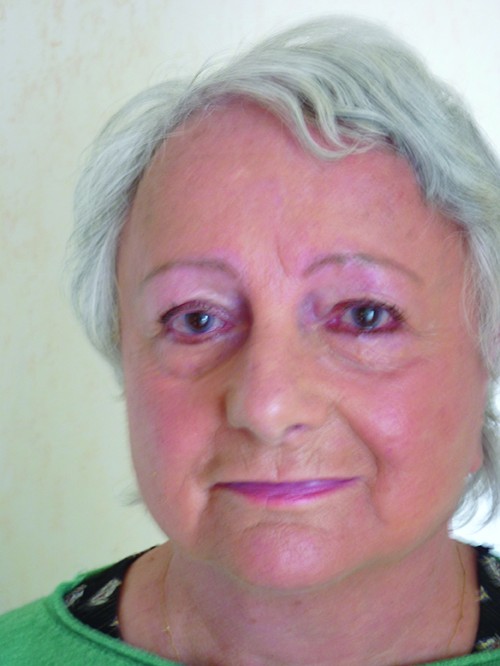 Pierrette Osmont